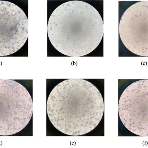 Microscopic Image Of Untreated MCF 7 Cell A MCF 7 Cell Treated With