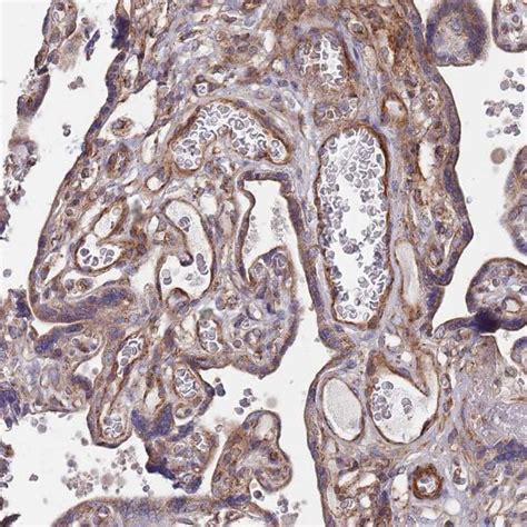 WDFY3 Polyclonal Antibody Invitrogen 100 μL Unconjugated Antibodies