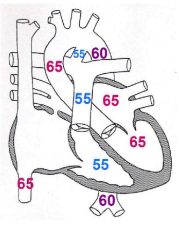 Neonatologie Herz Und Kreislauf Geburtstraumata Und Mehrlinge