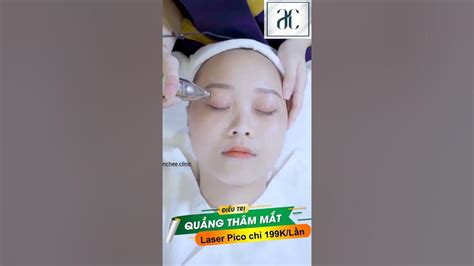 Laser Trị Xóa Quầng Thâm Mắt Tại Spa 199k Laser Picosure Đắp Mặt Nạ