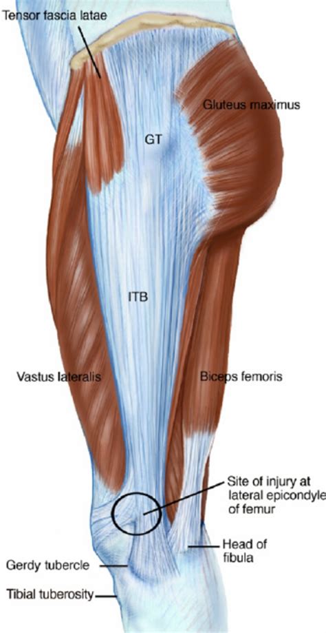 Iliotibial Ligament