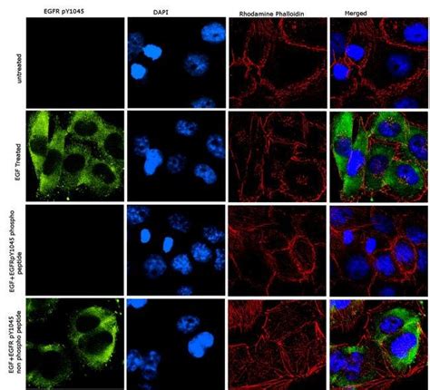 Phospho EGFR Tyr1045 Recombinant Polyclonal Antibody Invitrogen 100