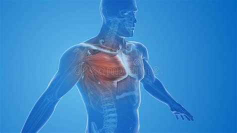 Anatomy of a Pectoral Strain or Chest Muscle Stock Illustration ...