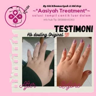 Jual Whitening Hb Dosting Anggur Original Shopee Indonesia