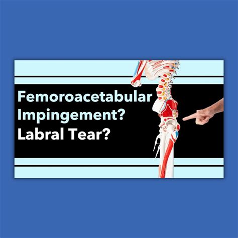 What is Causing Your Hip Pain? Femoroacetabular Impingement (FAI ...