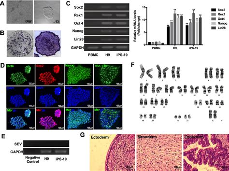 Characterization Of Gsphi A A Generated Ipscs Displayed Typical