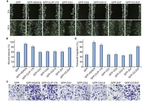 HDAC6 Coordinates With CLIP 170 To Regulate Pancreatic Cancer Cell