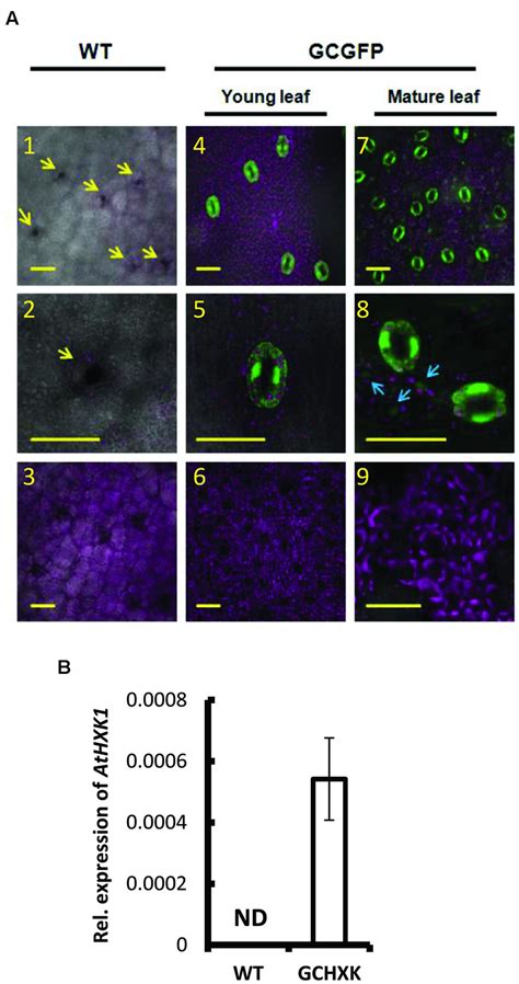 Expression Pattern Of Kst Gfp In Citrus And Expression Level Athxk