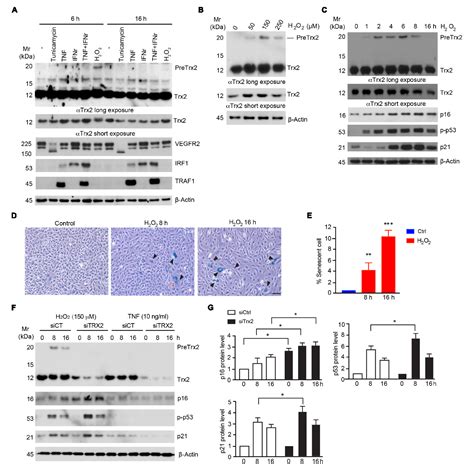 Figure From A Unique Sumo Interacting Motif Of Trx Is Critical For