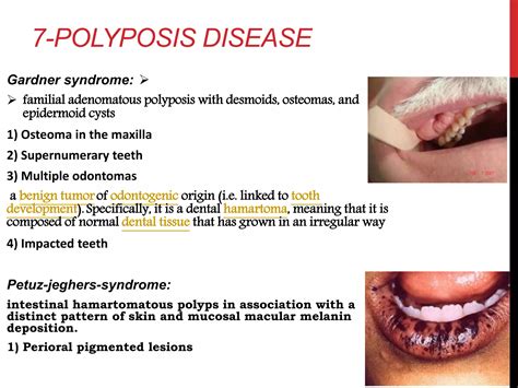 Oral Manifestations Of Systemic Disease Ppt