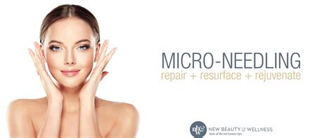 Rf Microneedling Westport And New Canaan Secret Rf