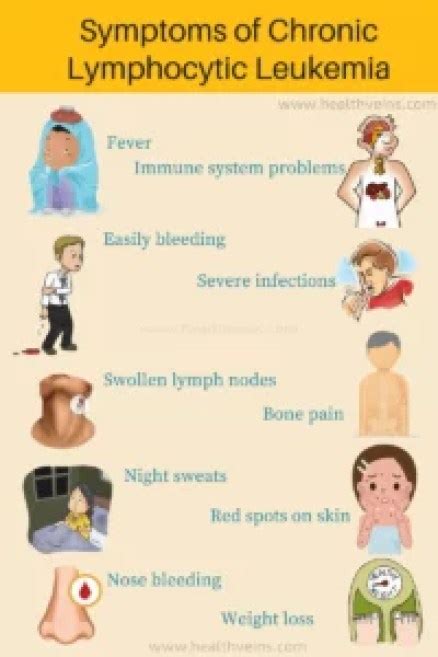 Chronic lymphocytic leukemia diagnosis and treatment - Healthveins