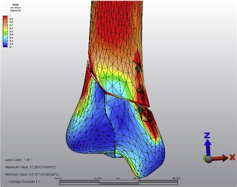 Figure From Finite Element Analysis Of The Stability Of Ao Ota C