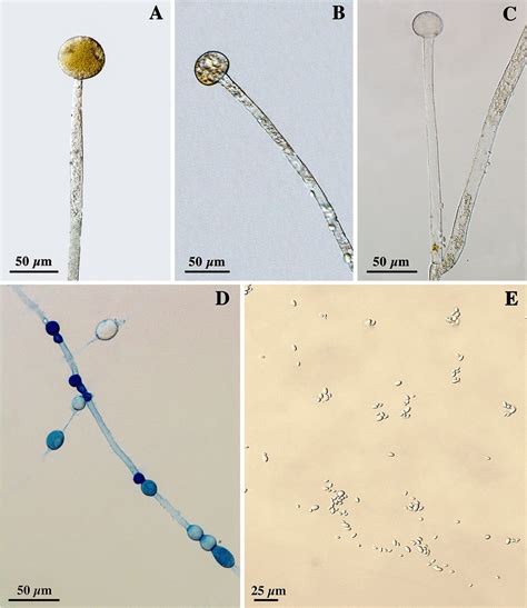 Mucor Indicus Urm 7222 A Sporangiophore Simple With Sporangia B