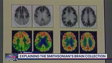 Smithsonians Brain Collection Townsville Bulletin