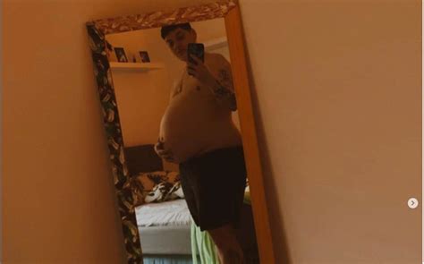 Transgender Man Pregnant