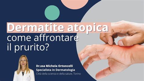 Dermatite Atopica Come Affrontare Il Prurito Derma Point YouTube