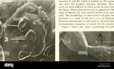 Saccharomyces Cerevisiae Drawing Hi Res Stock Photography And Images