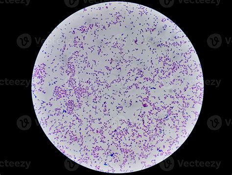 Escherichia Coli Bacterium Li Gram Negative Rod Shaped Bacteria Part Of Intestinal Normal