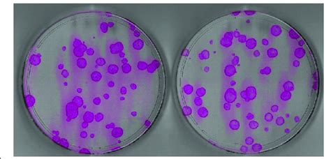 Colony Forming Efficiency Assay A Simple Way Of Measuring The Download Scientific Diagram