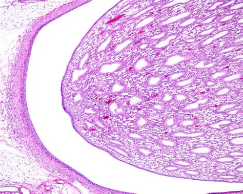 Renal Pelvis Histology Labeled