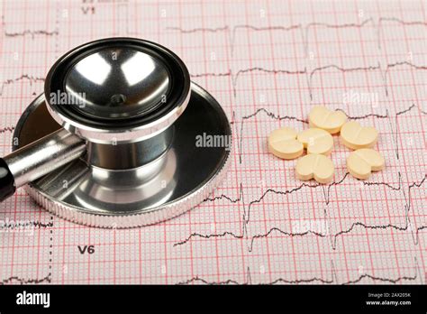 Electrocardiograma Gr Fico Informe Con Estetoscopio Sobre Ella