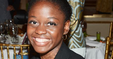 Ballerina Michaela Deprince Talks Ballet And Vitiligo