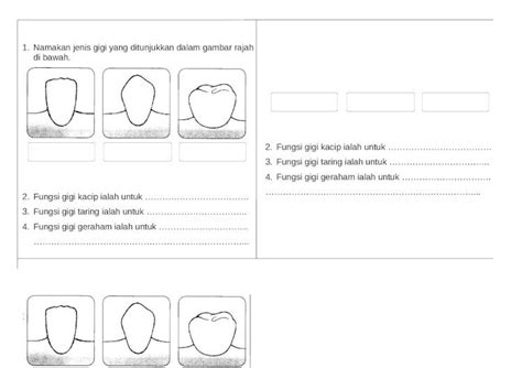 Docx Web Viewnamakan Jenis Gigi Yang Ditunjukkan Dalam Gambar Rajah