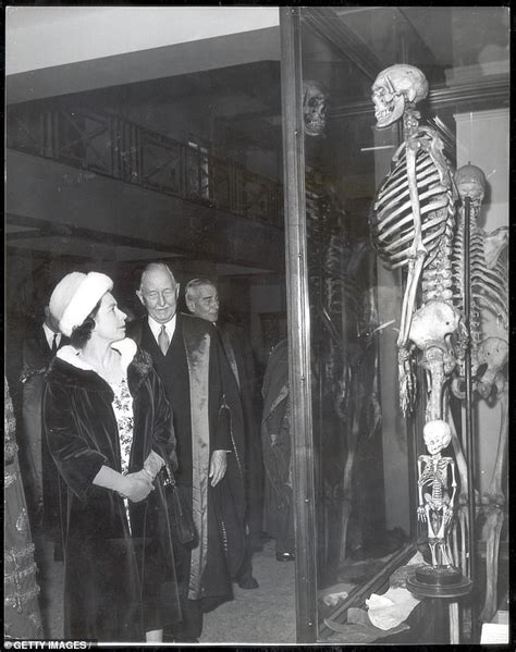 Skeleton Of The Irish Giant Is Removed From London Museum Big World