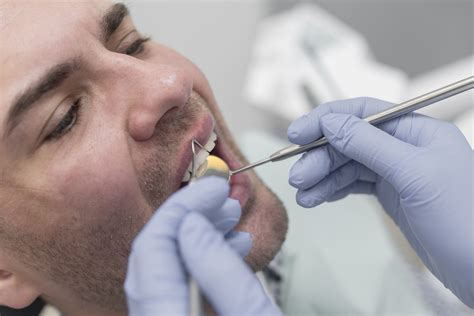 Cirugía Mucogingival Mejora Estética y Salud Periodontal Clínica Colodro