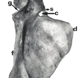 Ossification Of Transverse Scapular Ligament In Population 47 OFF