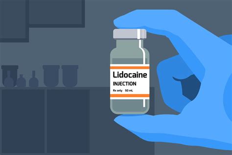 How long does lidocaine last? Know Efficacy - MedicalBuck