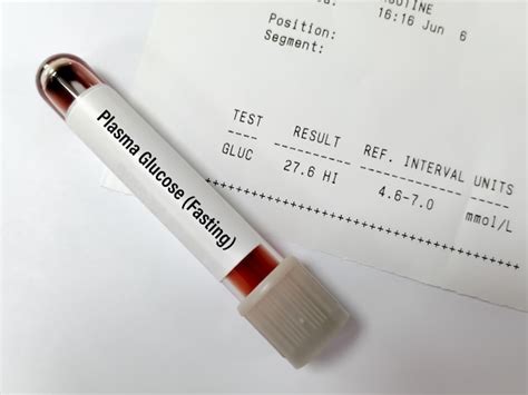 Premium Photo Sample Tube Of Plasma Glucose Fasting Test With