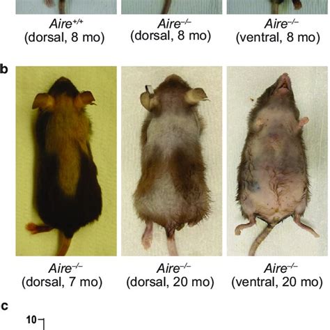 Genetic Ablation Of Aire Leads To Spontaneous Alopecia In Adult