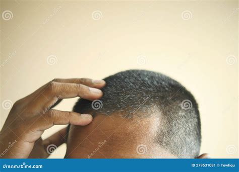 Hair Loss Concept With Man Checking His Hair Stock Image Image Of