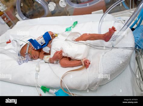 Premature Baby In An Incubator Stock Photo Alamy