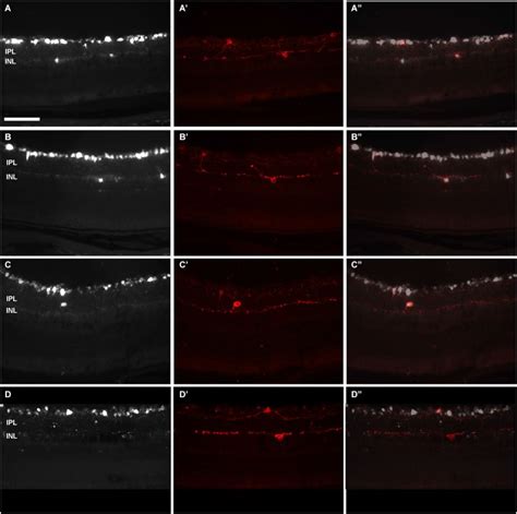 Distribution Of Melanopsin Positive Neurons In Pigmented And Albino