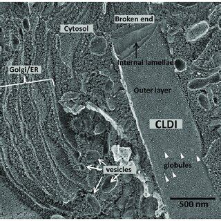 Deep Etch Freeze Fracture Electron Microscopy Of Isolated CLDIs A