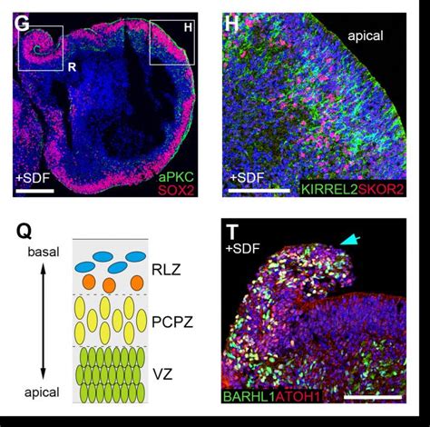 Continuous Neuroepithelium and [IMAGE] | EurekAlert! Science News Releases