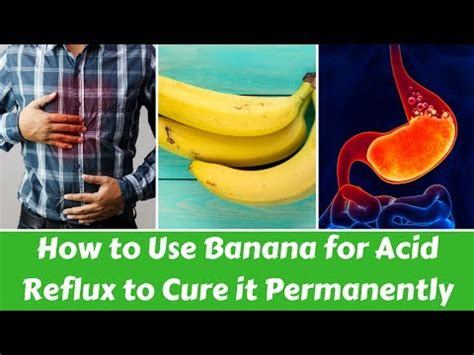 How to use bananas for acid reflux treatment for permanent cure – Health