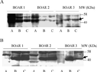 Specific Expressions Of Hexose Transporters Glut And Glut In