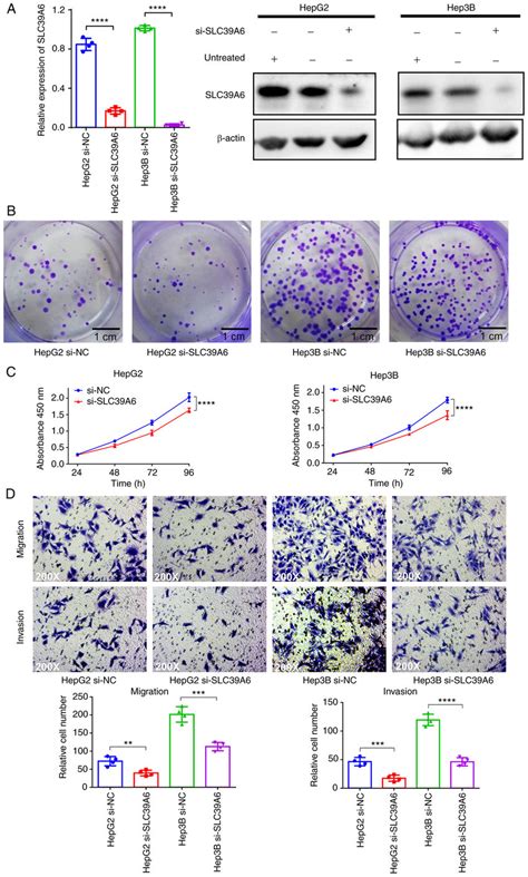 Knockdown Of Slc39a6 Inhibits Liver Cancer Cell Growth Migration And