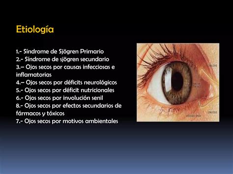 Glaucoma Catarata Y Sd Ojo Seco PPT