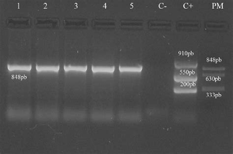 Pcr Anidada Para Detectar El Wssv Electroforesis En Gel De Agarosa