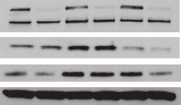 Smrt Regulation Of Er Target Genes Is Gene Specific A Western Blot