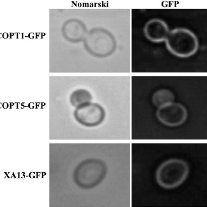 Localization Of COPT1 GFP COPT5 GFP And XA13 GFP In Yeast MPY17 Cells