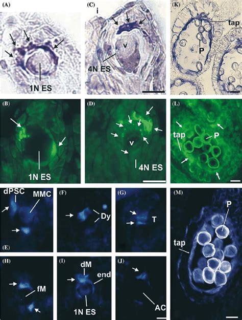 Comparison Of Msmob1 23 Transcript And Protein Localization Patterns Download Scientific