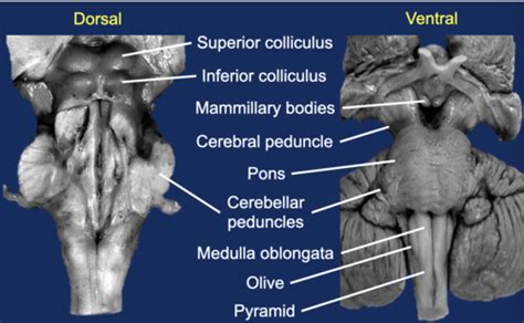 Brain Stem Cerebellum Structure And Function Flashcards Quizlet