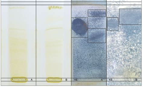 Contact Bioautography From Left To Right Tlc Of Parastrephia