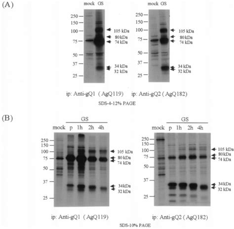 Immunoprecipitation Of 35 S Methionine Labeled Strain Gs Infected